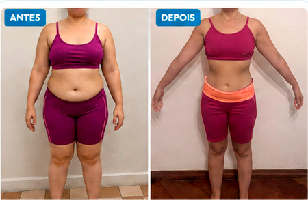 Comparação antes e depois do paciente Letícia M.